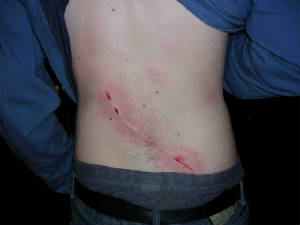scars.jpg